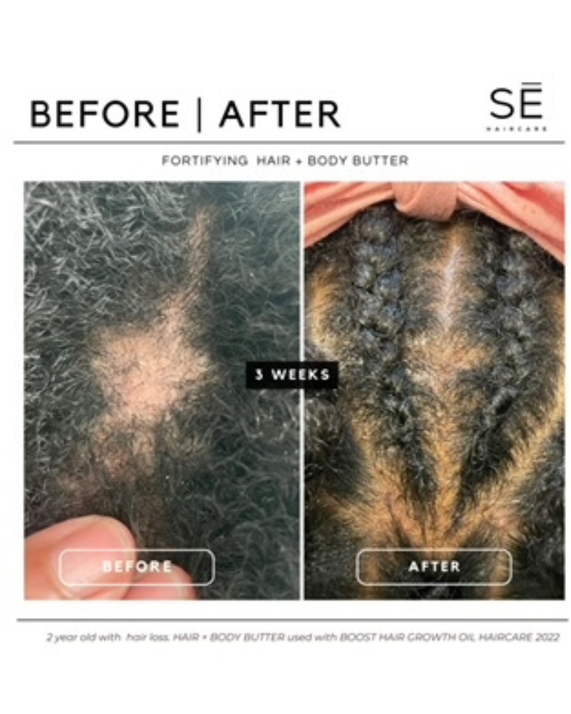 BOOST Hair Growth Oil