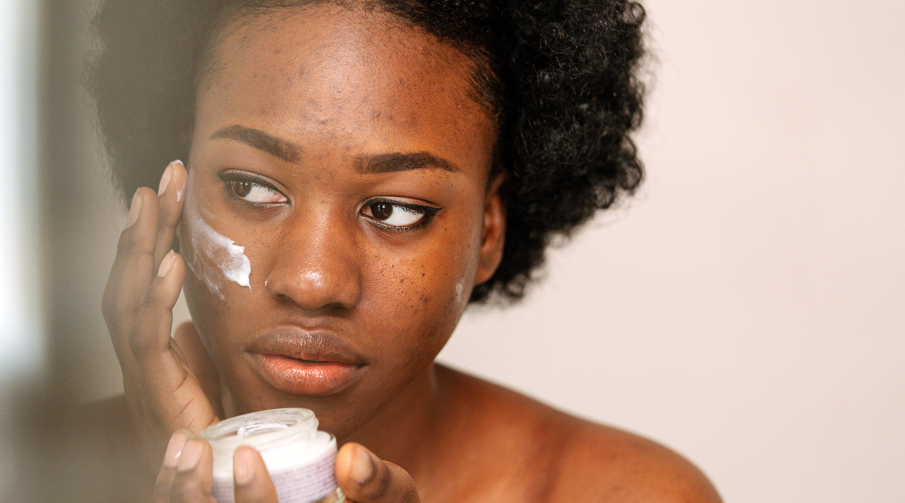 How to Identify Different Types of Acne Scars and the Best Treatment for Each